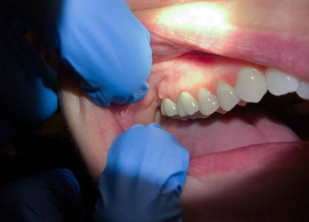 Best Broken or Cracked Tooth Emergency Dentist in Neodesha, KS